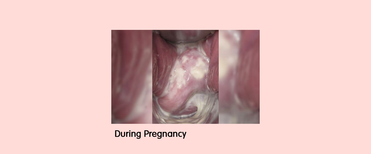 6 Images Of Your Cervix You Need To See Youly