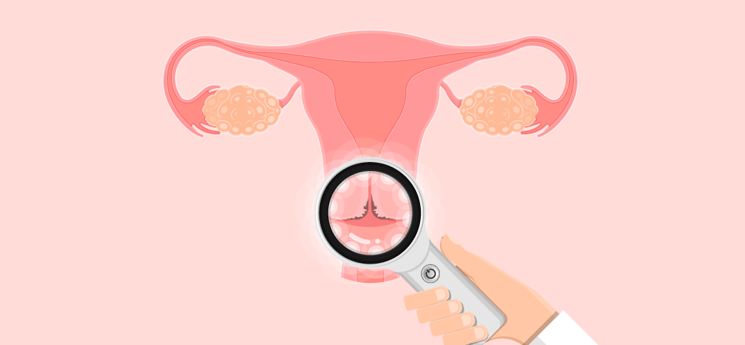 6 Images Of Your Cervix You Need To See