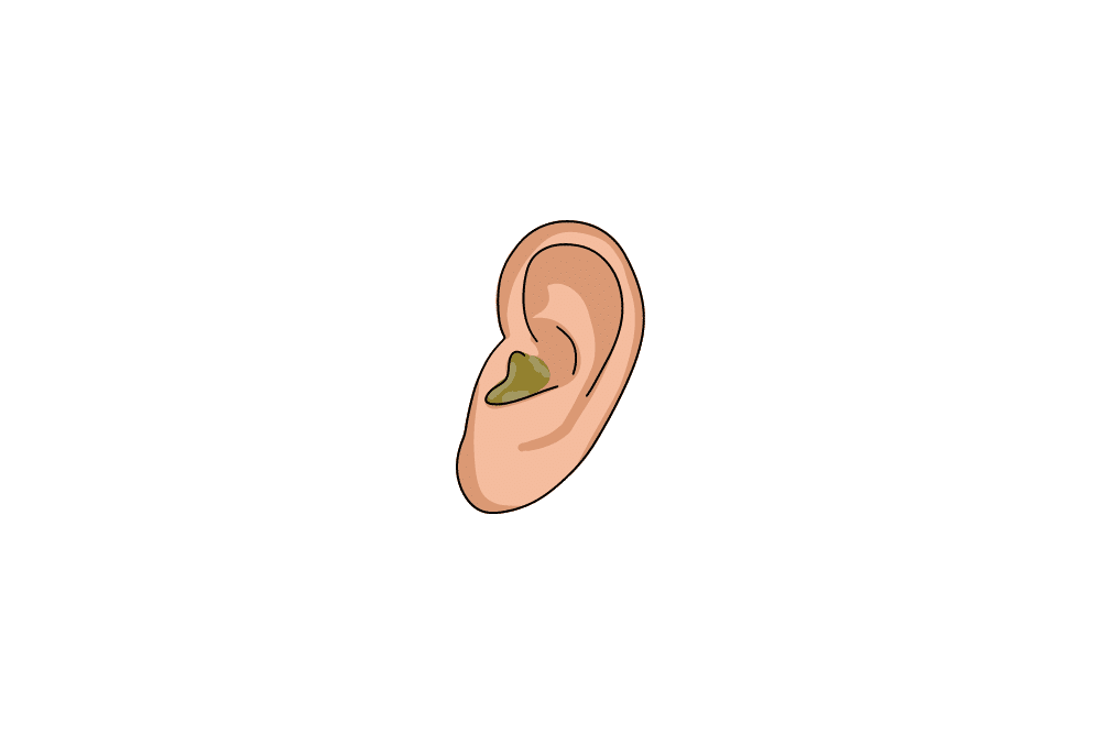 Ear infection