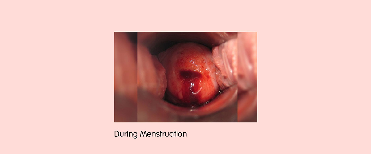 cervix before and during pregnancy