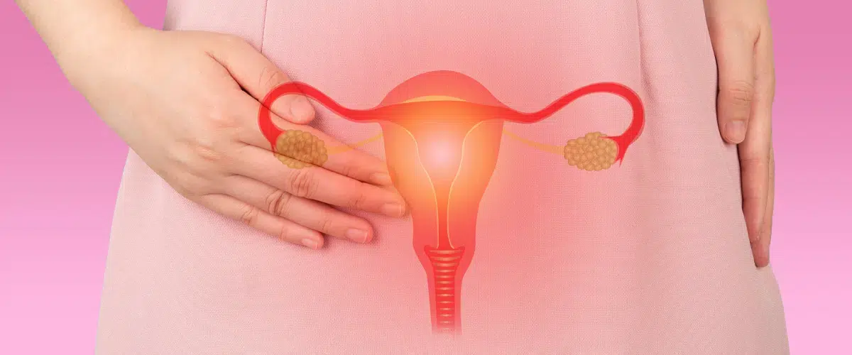 Everything You Need to Know About Painful Period Cramps - Youly